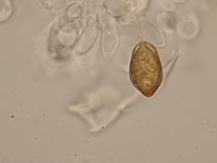Descomyces albus