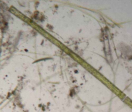 Pleurotaenium gloriosum