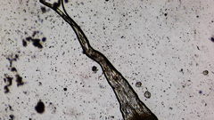 Racomitrium heterostichum