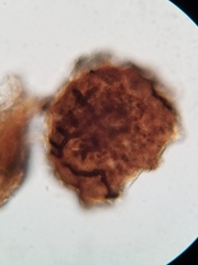Lichenostigma