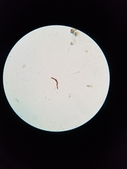 Lichenostigma
