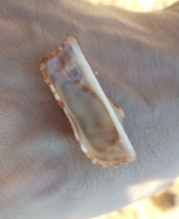 Arca navicularis