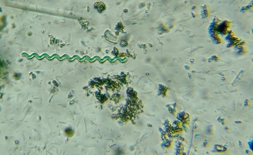 Arthrospira jenneri, 2025-10-26