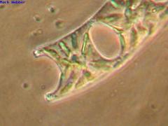 Eucampia zodiacus