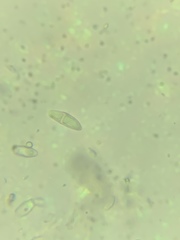 Anisomeridium biforme