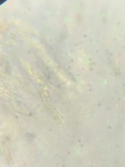 Anisomeridium biforme