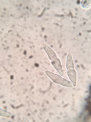 Glonium stellatum