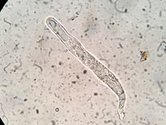 Glonium stellatum