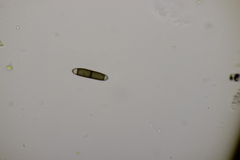 Chaetosphaerella phaeostroma