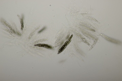 Chaetosphaerella phaeostroma