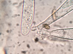 Durella melanochlora