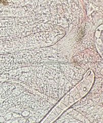 Lasiobolus microsporus