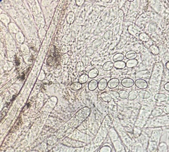 Lasiobolus microsporus