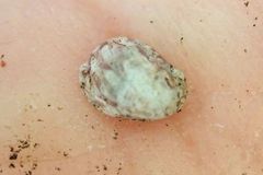 Theodoxus fluviatilis