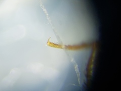 Rismethus squamiger
