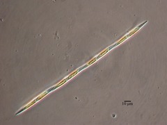 Pseudo-nitzschia