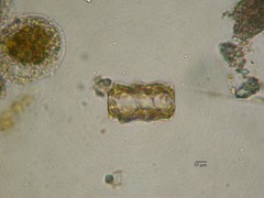 Asteromphalus heptactis