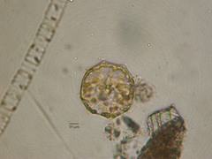 Asteromphalus heptactis