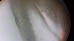 Brachythecium laetum