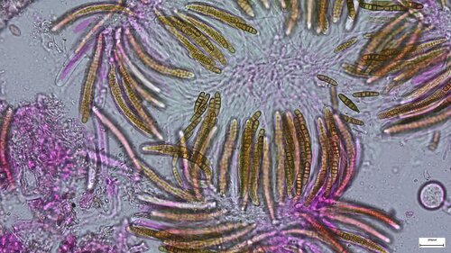 Phaeosphaeriopsis glaucopunctata