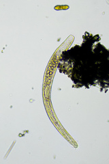 Spirostomum