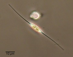 Cylindrotheca closterium