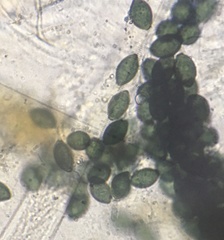 Podospora setosa