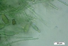 Cylindrospermum muscicola