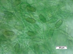 Cylindrospermum muscicola