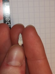 Tritia varicosa