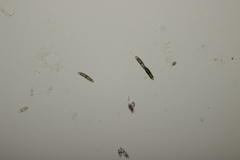 Chaetosphaerella phaeostroma