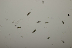 Chaetosphaerella phaeostroma
