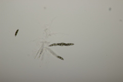 Chaetosphaerella phaeostroma