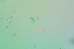 Polycauliona luteominia luteominia