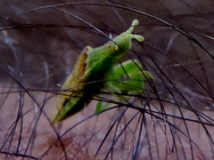 Lophoscutus