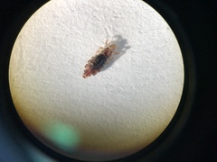 Pediculus humanus
