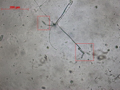 Arthrobotrys dactyloides