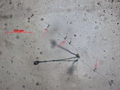 Arthrobotrys dactyloides