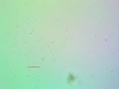Sarcogyne similis