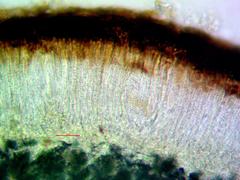Sarcogyne similis