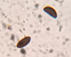 Annulohypoxylon annulatum