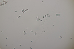 Byssocorticium atrovirens