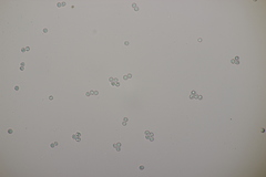 Byssocorticium atrovirens