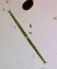Triploceras gracile