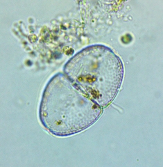 Cosmarium pyramidatum