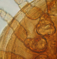 Uropoda orbicularis