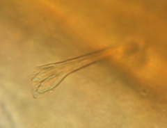 Uropoda orbicularis