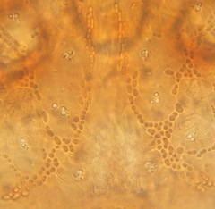 Uropoda orbicularis