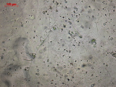 Orbiliales