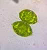 Xanthidium tumidum - Photo (c) Karolina Fucikova, some rights reserved (CC BY-NC), uploaded by Karolina Fucikova